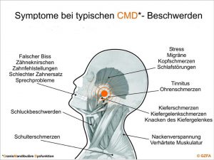 Symptome bei typischen CMD-Beschwerden